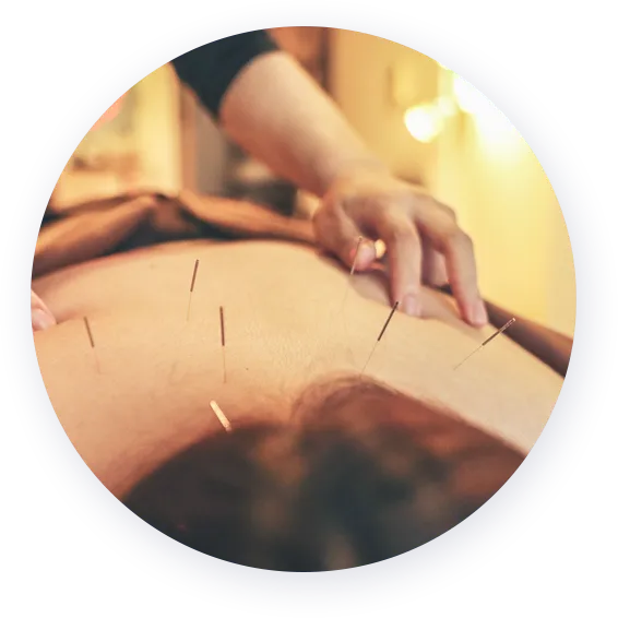 鍼灸マッサージ